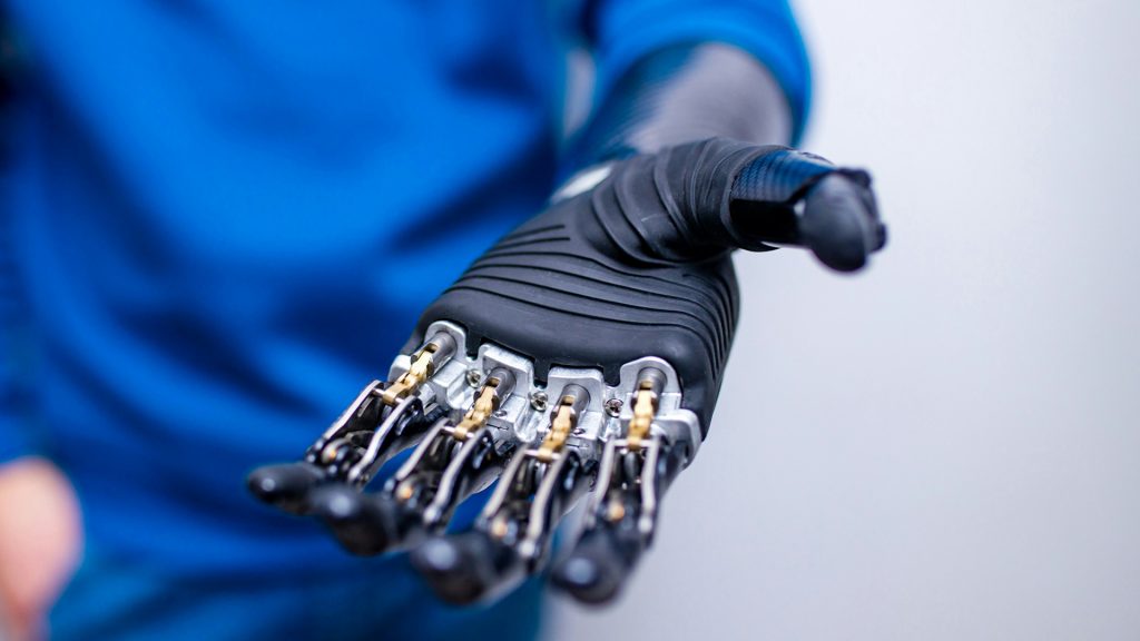 Moderne bionische Handprothese mit feinmechanischen Komponenten – Branchenseite MedTech von PFIF